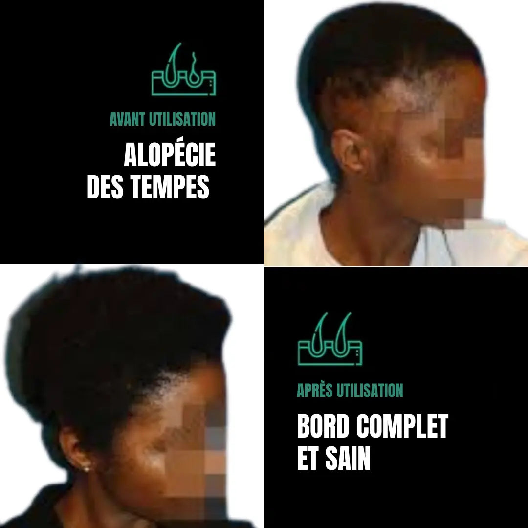 Huile de Batana 100% Pure H-exotique