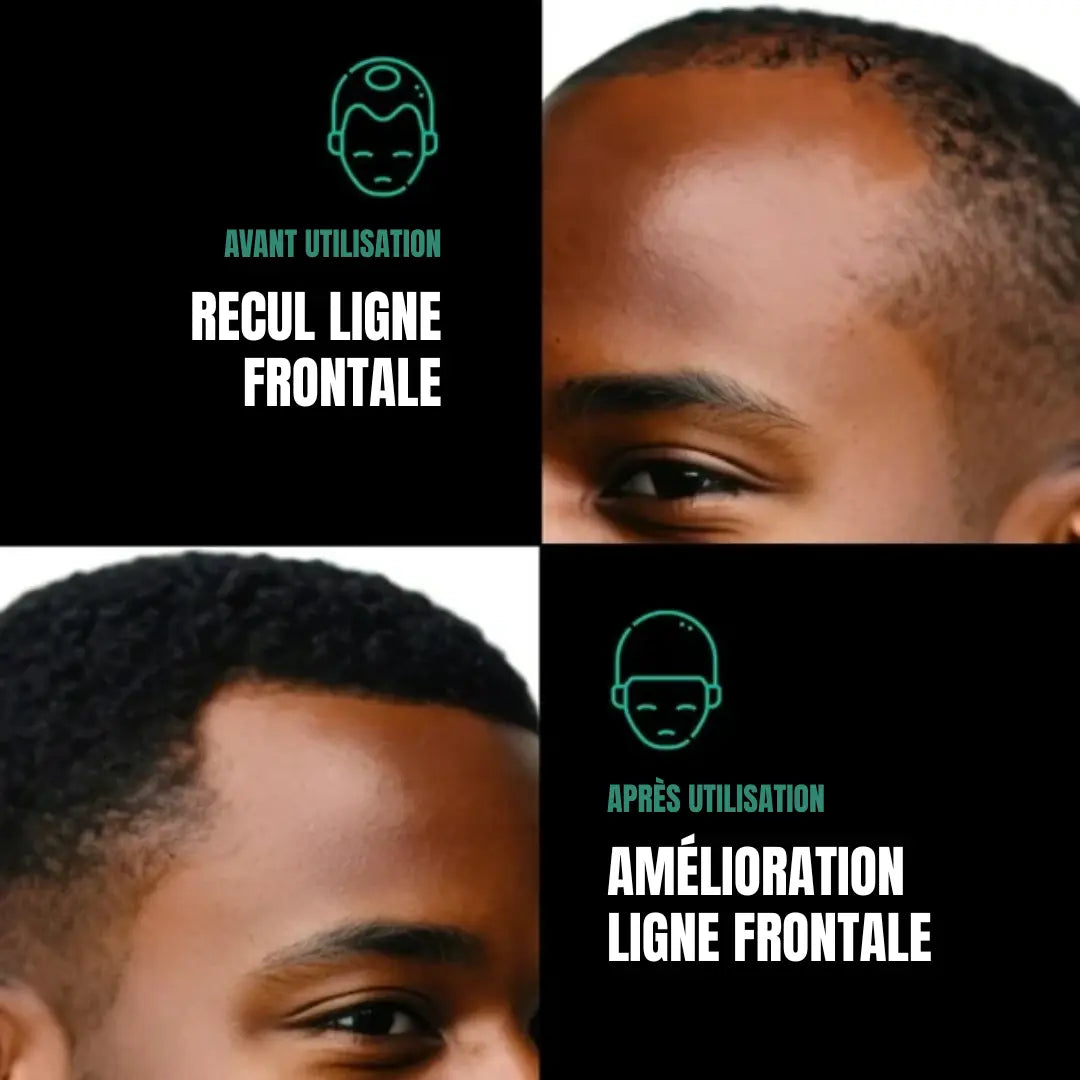 Huile de Batana 100% Pure H-exotique